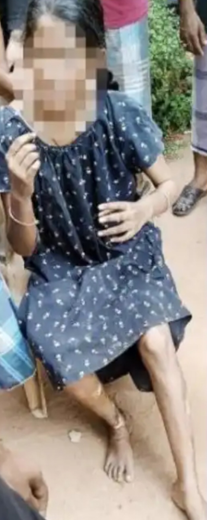 ଆଖି ବୁଜିଲେ ବଳଙ୍ଗା ପୀଡ଼ିତା ।